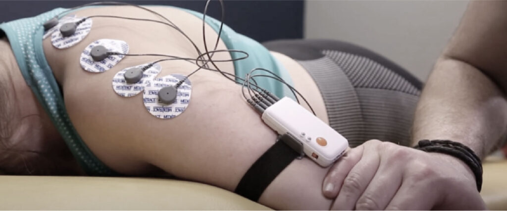 Electromiografía qué se siente, cuánto duele y cómo prepararte sin miedo